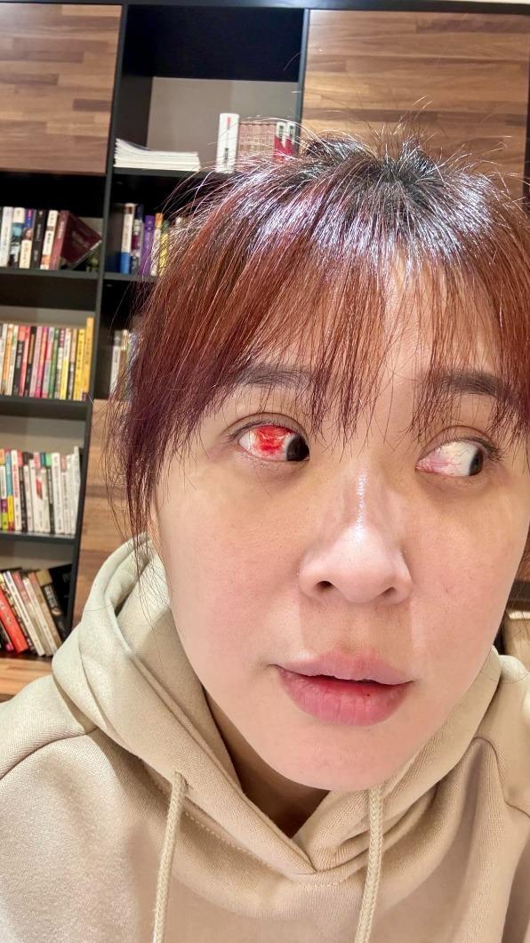 李燕分享自己眼睛爆血絲照片，自嘲「殺紅眼了」。（圖／翻攝自李燕臉書）