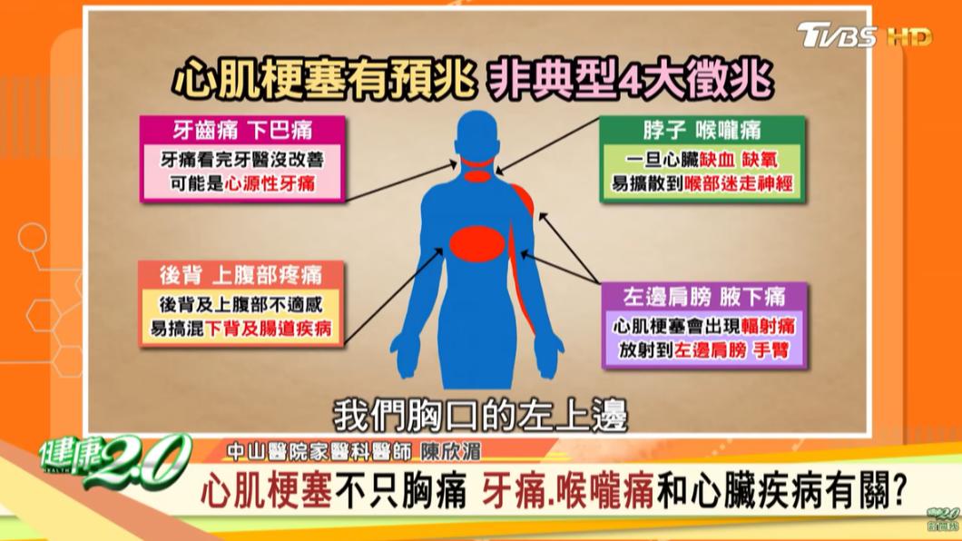 非典型心肌梗塞4大徵兆。(圖/翻攝自健康2.0 YouTube)
