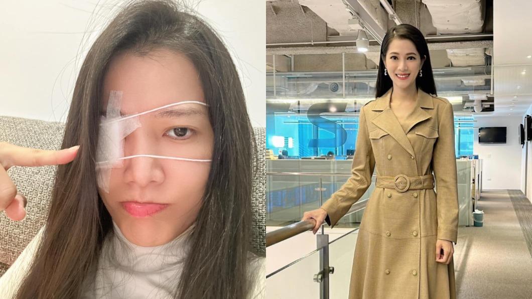 女主播以為長針眼卻是「眼瞼腫瘤」!醫提醒:反複發作要小心