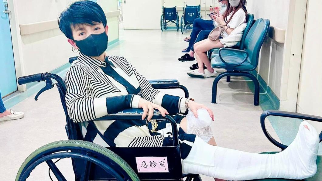 出事了！64歲女星「跌倒摔斷腿」急送醫　右膝骨裂慘況曝