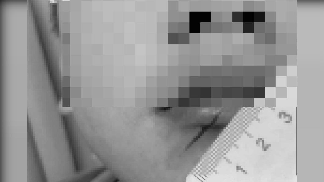 小瑞遭小晨拿美工刀劃傷。（圖／翻攝自陳允萍臉書）