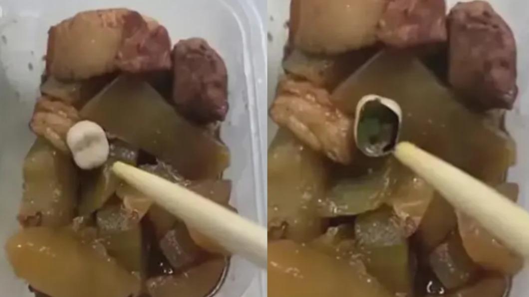 醫院餐盒驚見「牙冠」！陸衰男崩潰喊噁　院方急辯：可能是骨頭