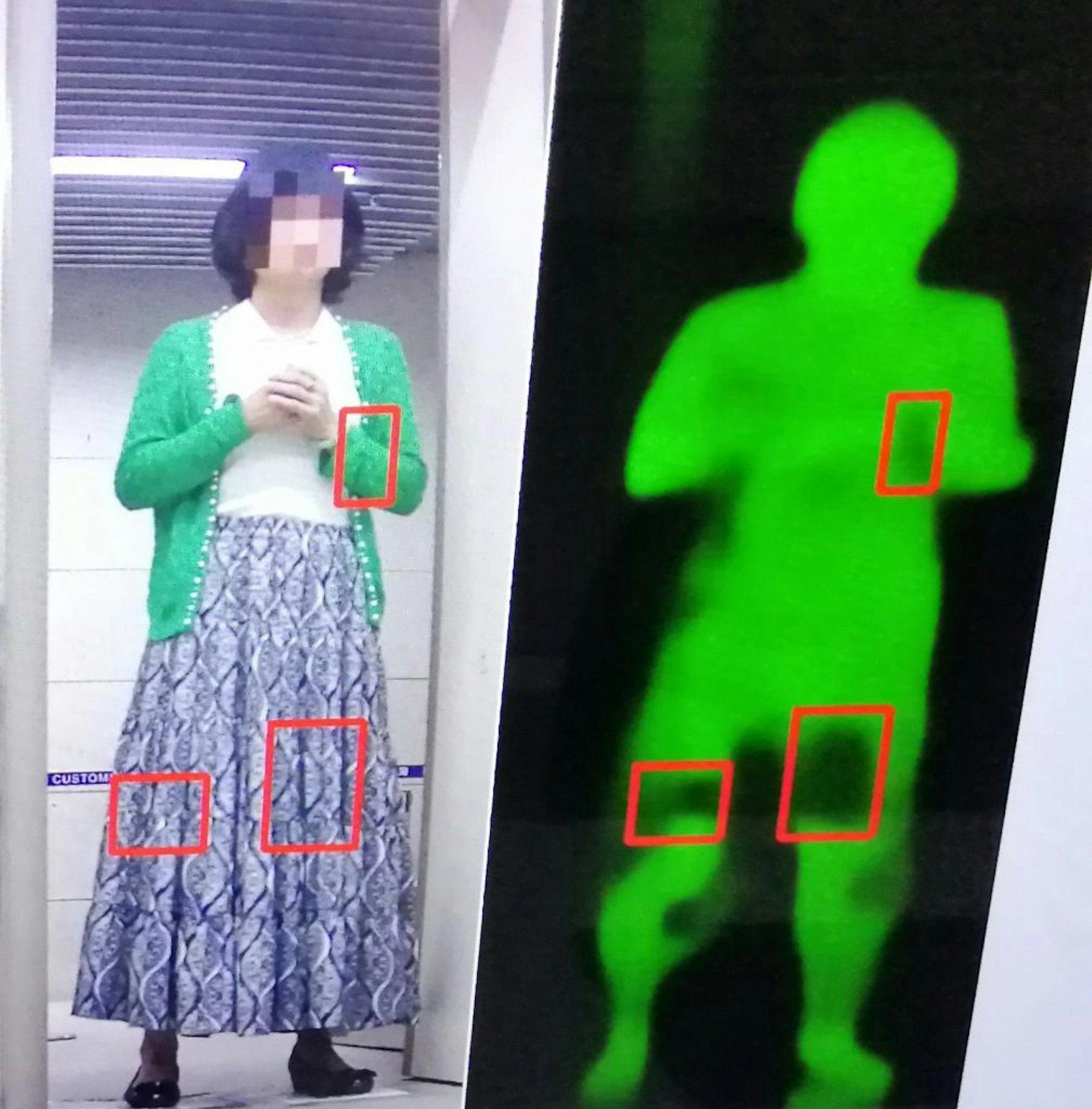 婦人走路步伐異常，被發現離譜走私案。（圖／翻攝自澳門海關）