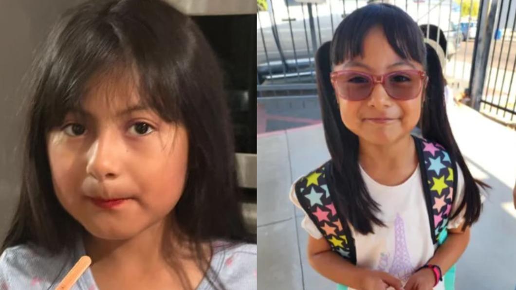 嘴唇手掌突變藍 美7歲女童感染「致命細菌」慘截肢保命