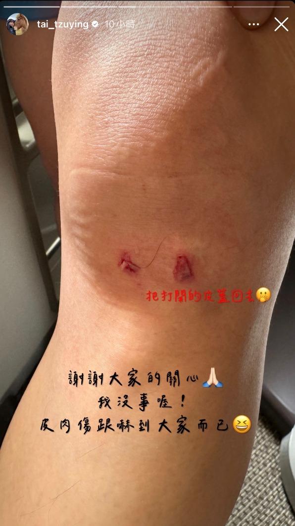 戴資穎受傷,所幸並無大礙。(圖/翻攝戴資穎IG)