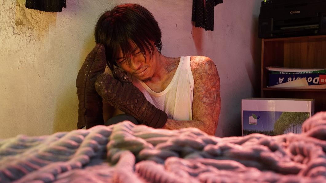 八點檔男星被火紋身「每天詛咒自己」 失眠陷陰霾遭逼看精神科