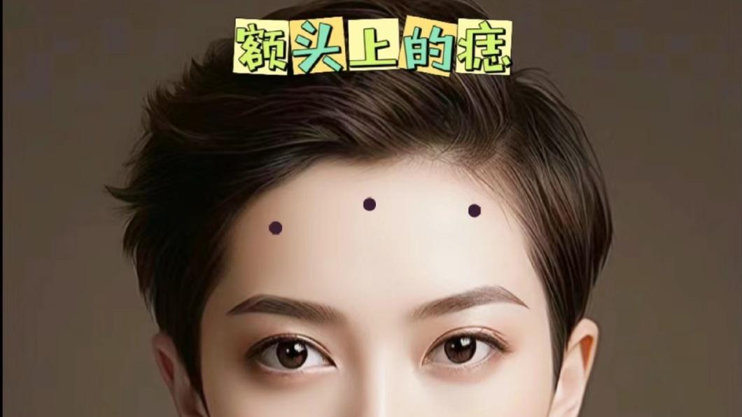 除了額頭中間的觀音痣是吉利的,其他地方若長痣,就代表著事業前途受阻。(圖/翻攝自小紅書)