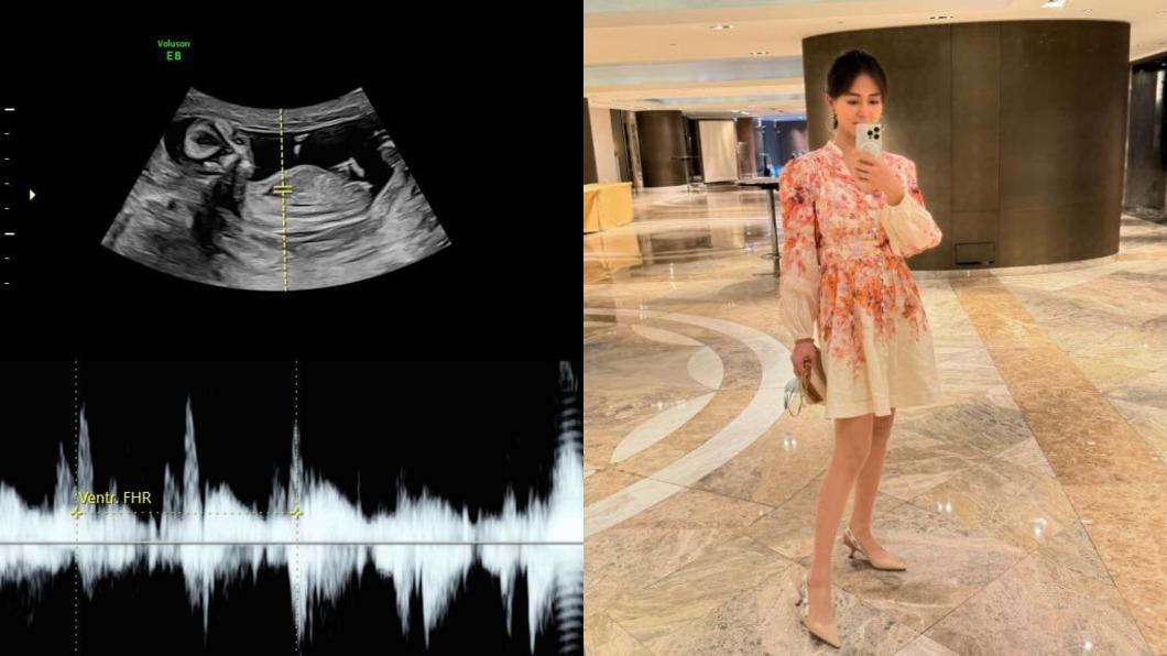40歲劉香慈屬高齡產婦,從未做過唐氏症檢測。(圖/翻攝自劉香慈臉書)