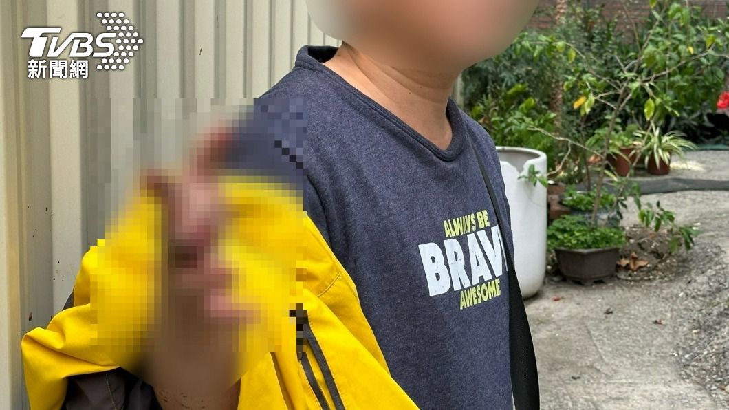 男保養檔車遭截斷手指　血流如注送醫慘接不回