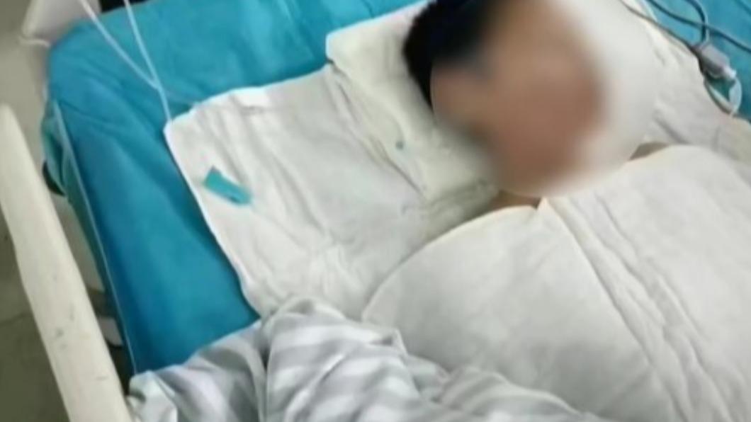 遭同學灌滾水「雙唇燙爛」!國中弟秒毀容 陸校:打鬧而已