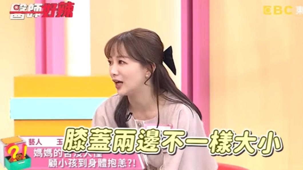 玉兔健康亮紅燈!帶娃1NG動作 膝蓋驚見「兩邊不一樣大」:沒辦法蹲