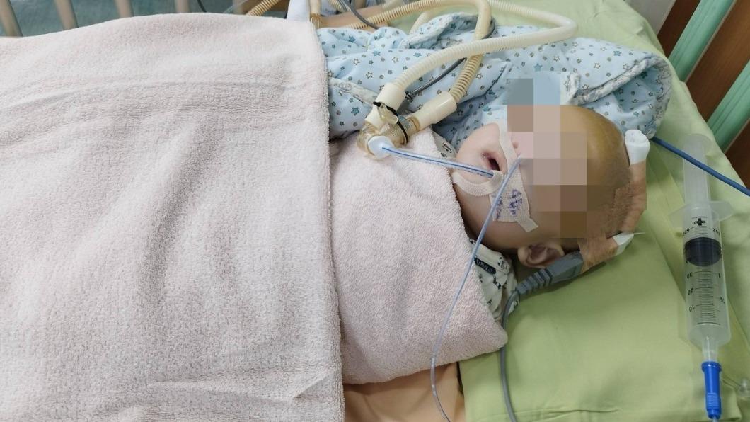 高雄男嬰疑受虐頭骨裂!保母稱「自己撞」 社會局:羈押調查中