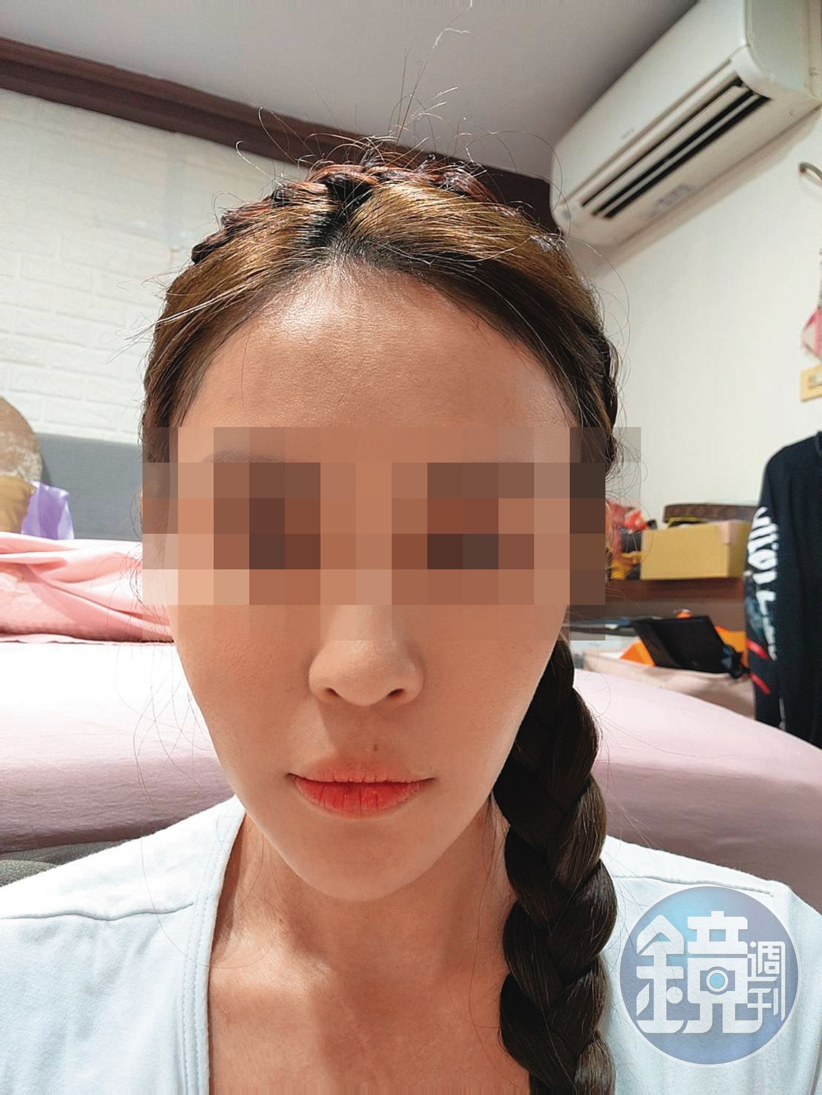 診所老客戶C小姐去年底進廠維修，沒想到手術失敗。（圖／鏡週刊讀者提供）