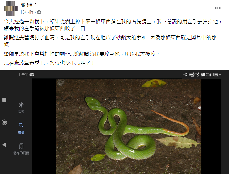 網友遭蛇咬傷,手腫成砂鍋大。(圖/翻攝自爆廢公社二館臉書)