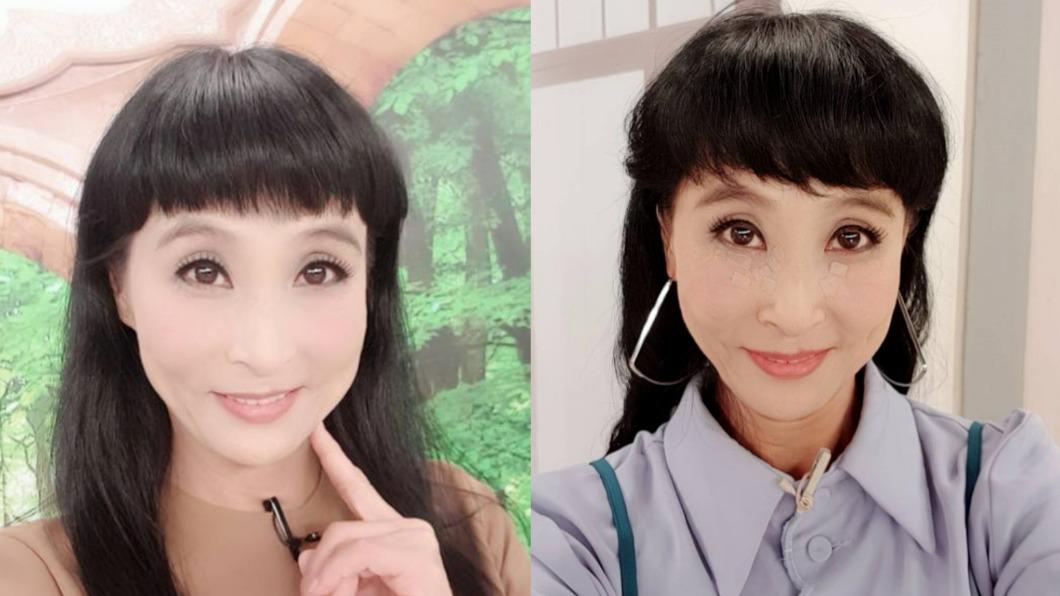 馬妞罹不死癌!發病全身癢「有如人間煉獄」 眼角膜破損12病纏身