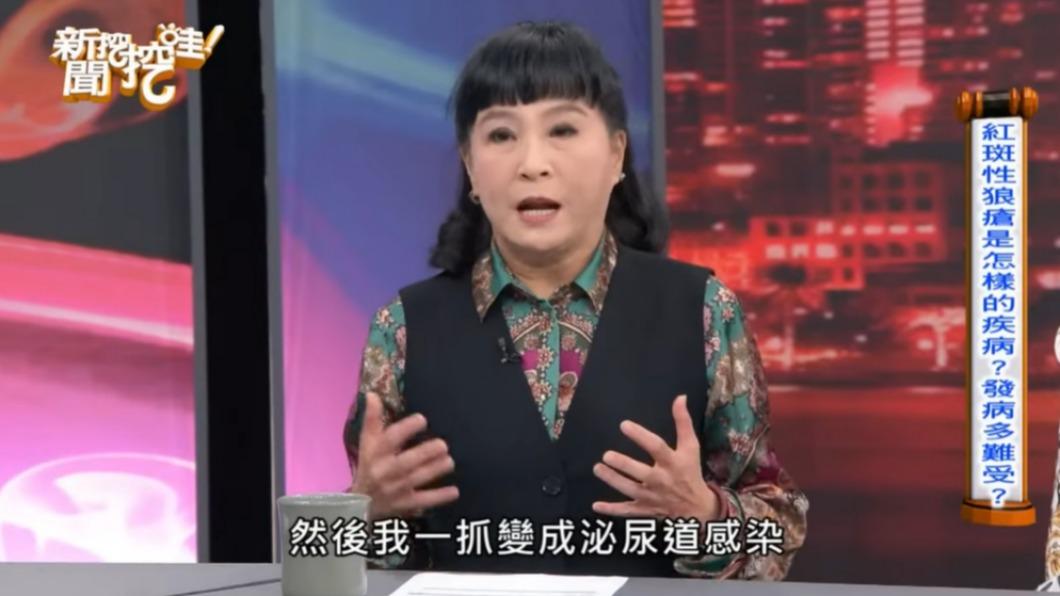馬妞罹患紅斑性狼瘡。(圖/翻攝自新聞挖挖哇YouTube)