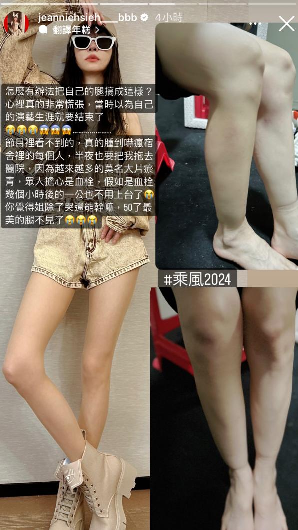 謝金燕練舞腿都腫起來。(圖/翻攝自謝金燕IG)