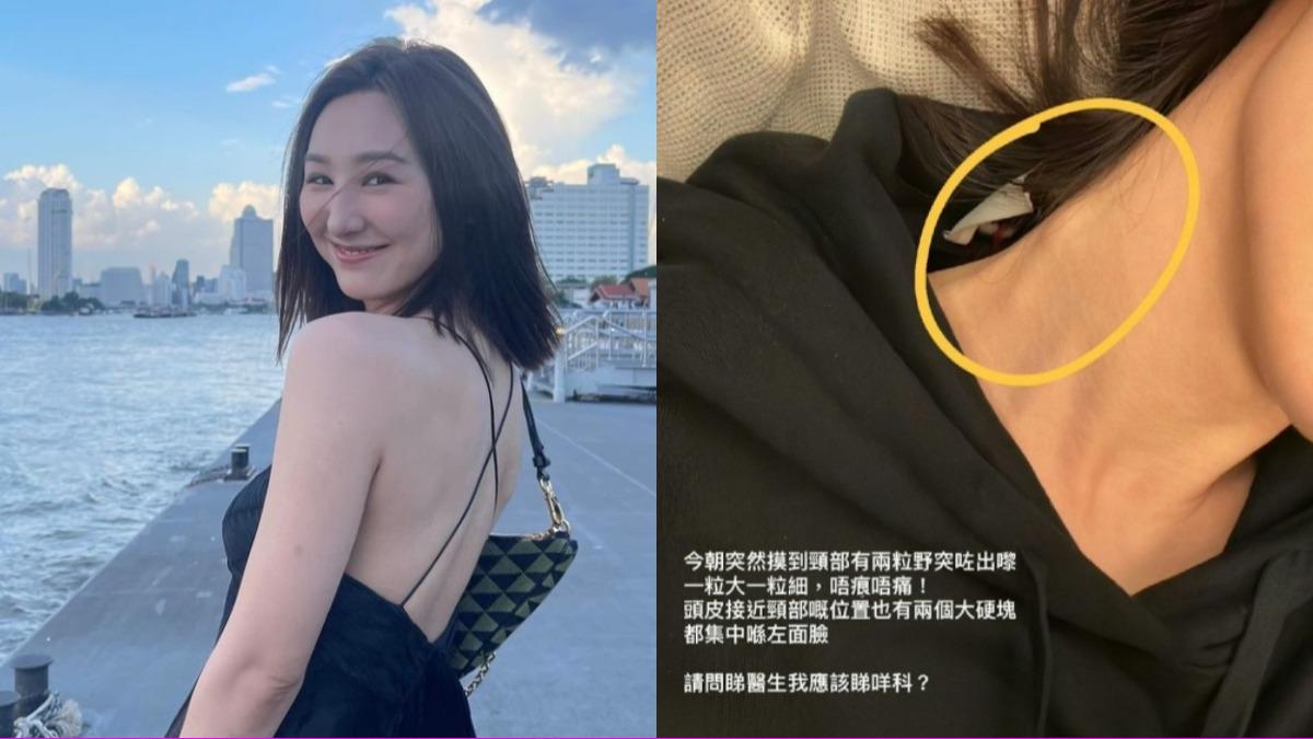 不痛要小心!《新聞女王》高海寧爆頸部硬塊 醫示警5狀況恐是癌