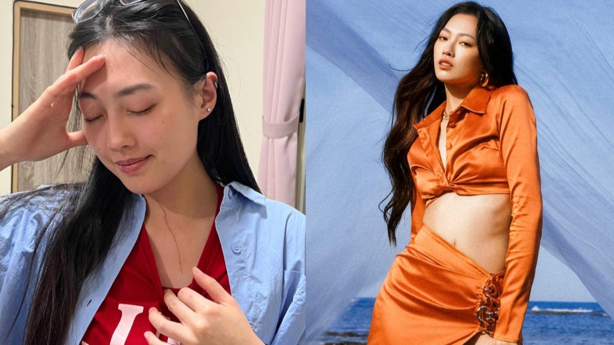 貓女兒下重手!A-Lin愛徒胸口冒驚人血痕 自嘲事業線變長