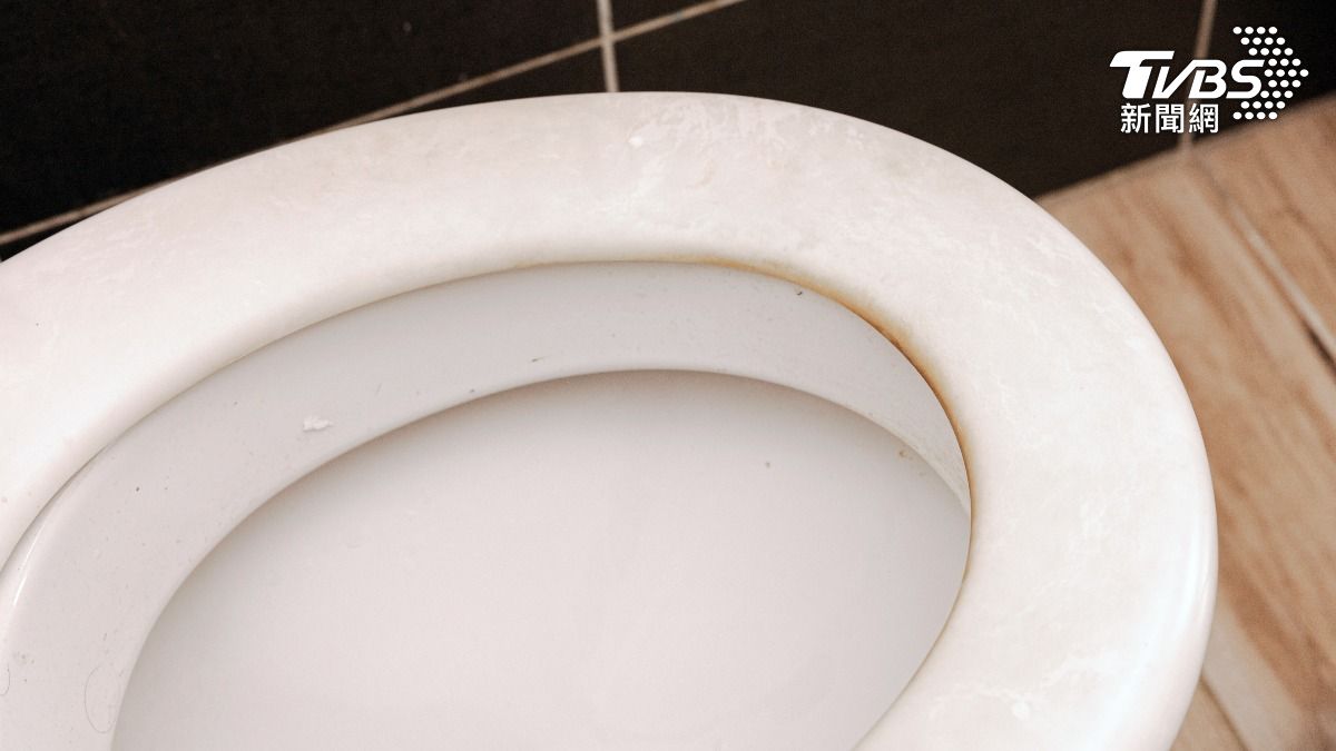 屁股懸空如廁釀禍! 年輕女膀胱「布滿細菌」血尿就醫
