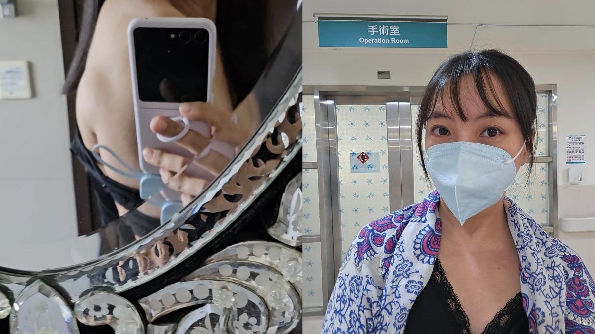 《戲說》女星擦乳液才驚覺「背部長了大肉球」 急開刀切除!病況曝光