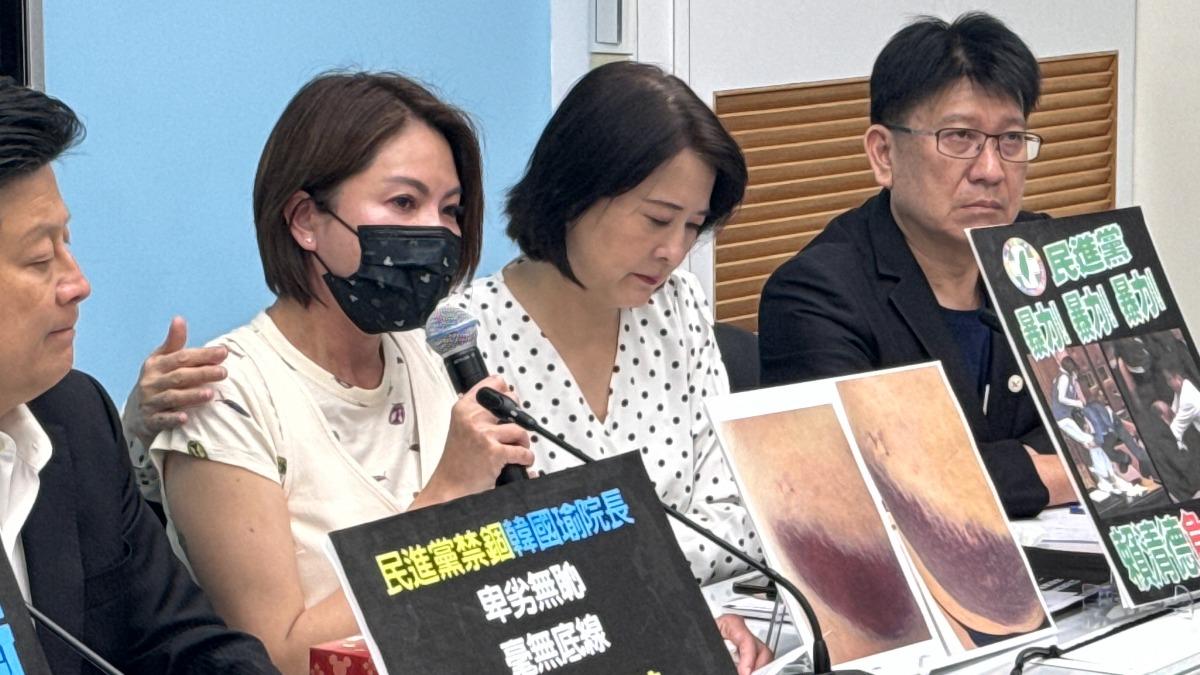 陳菁徽今(18)日在國民黨團記者會中公布「臀部大片瘀青」照。(圖/陳菁徽辦公室提供)