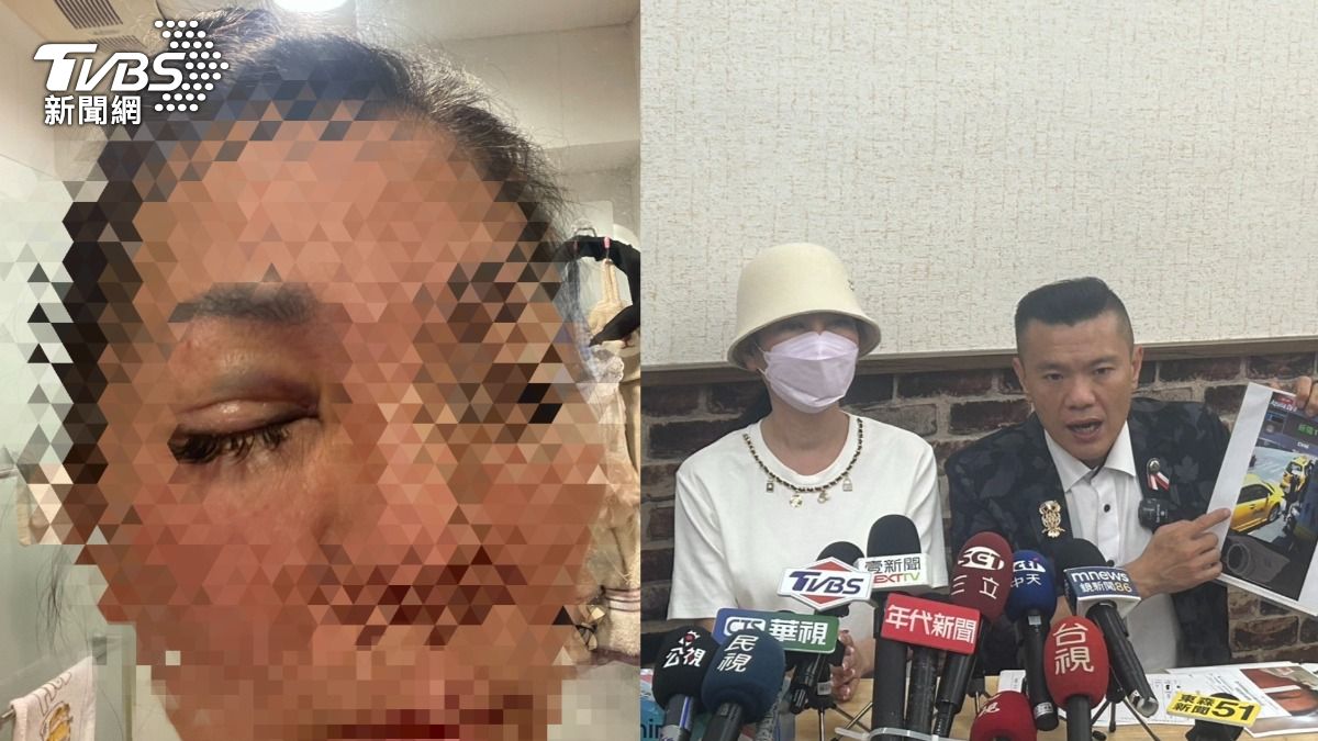 有片/台中女疑小黃繞路!慘遭運將「爆打2分鐘」 熊貓眼慘況曝