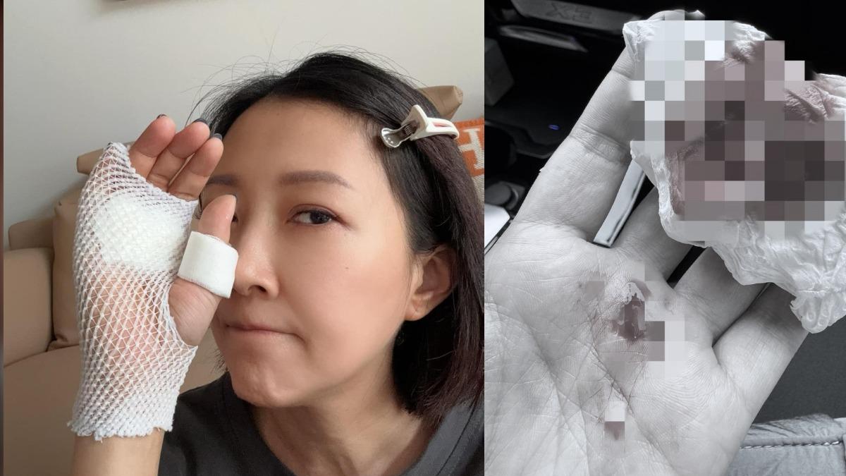 余皓然爆濺血意外驚險畫面曝 送醫縫5針!關鍵「小黃瓜」成急診室焦點