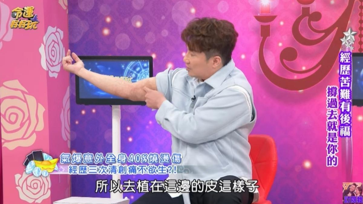 彭正露出手臂的傷痕。(圖/翻攝命運好好玩YouTube)