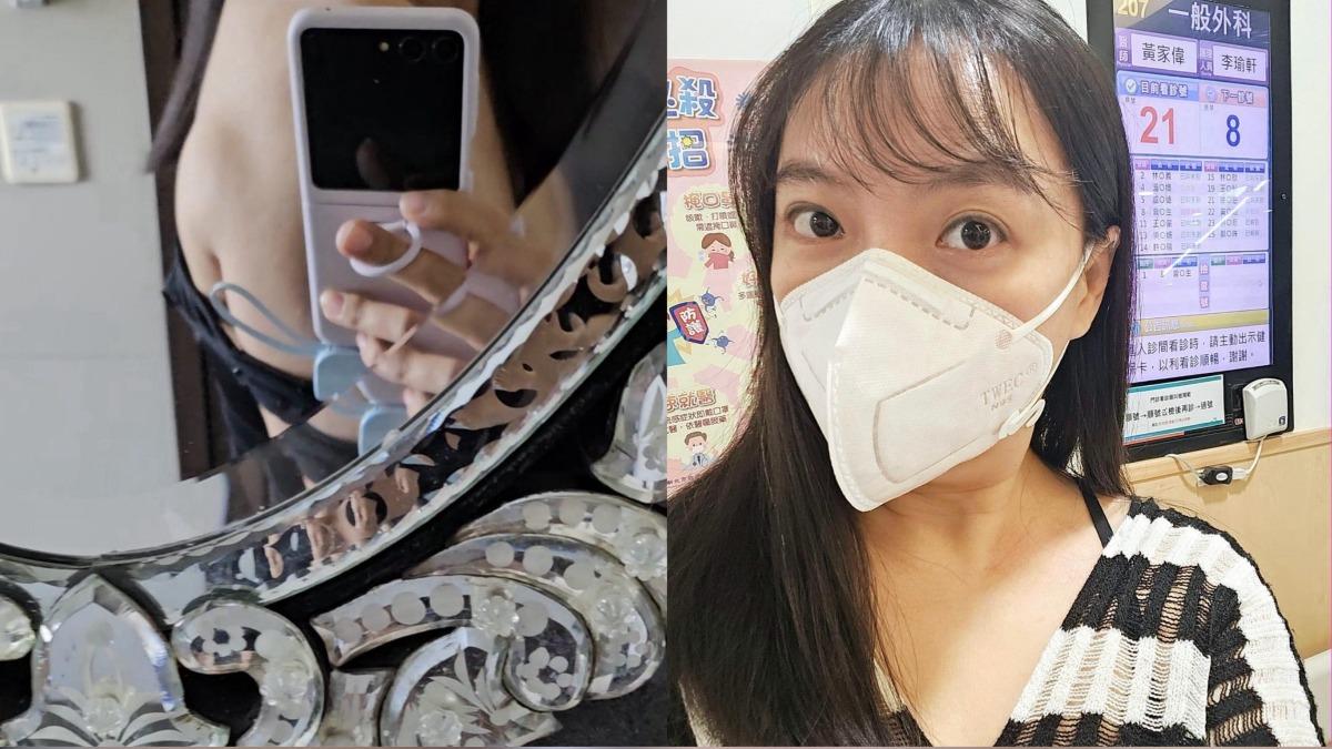 擦乳液驚摸到「背部大肉球」!女星急動刀切除 化驗結果出爐