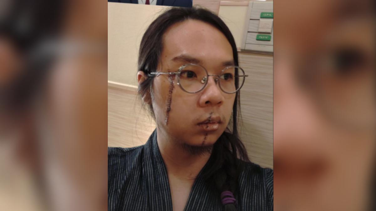 中捷「長髮哥」勇擋刀 美妝業者霸氣喊:免費幫英雄修疤!