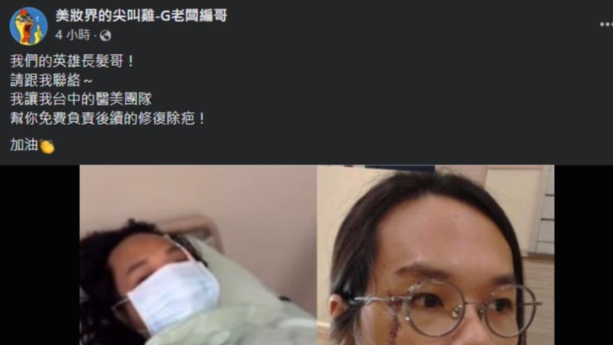 美妝業者宣布幫「長髮哥」免費修疤。(圖/翻攝自臉書美妝界的尖叫雞-G老闆編哥)