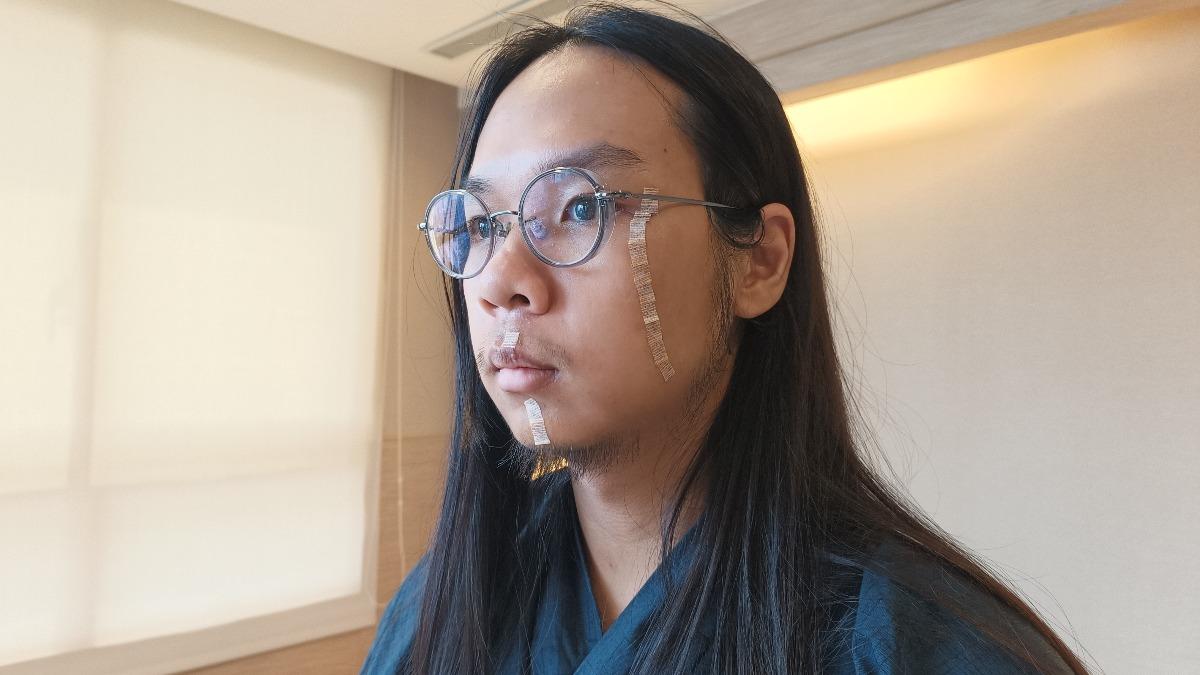 快訊/中捷長髮哥出院了!錄影喊謝謝關心:傷口恢復得很不錯