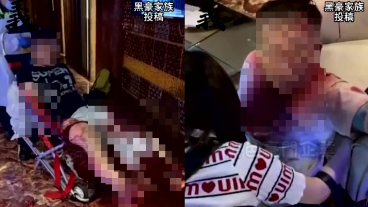 悚!新竹酒店顧客員工互砍滿身血 小姐驚逃、5人刀傷住院