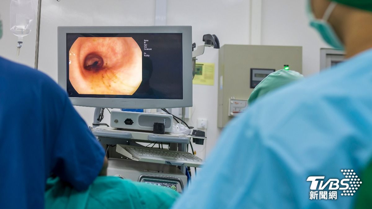 慎入!AI大腸鏡照出整片「密密麻麻顆粒」 醫護一看嚇壞尖叫