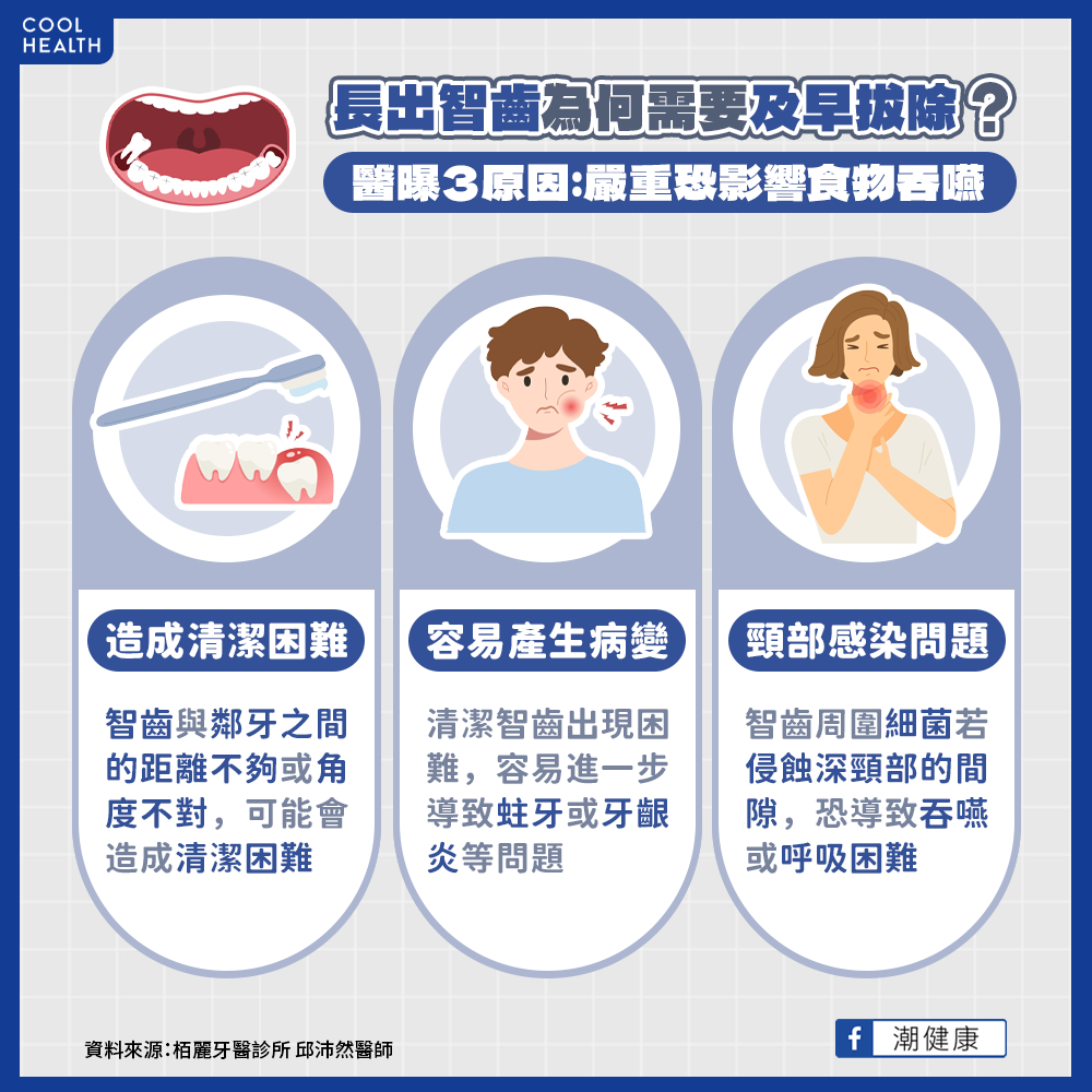 智齒建議提早拔除3原因。(圖/潮健康)