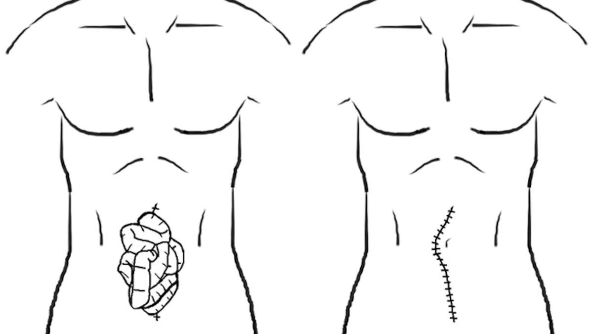 佛羅里達州63歲男子的個案被列入《美國醫學病例報告》中。(圖/翻攝自pubs.sciepub.com)