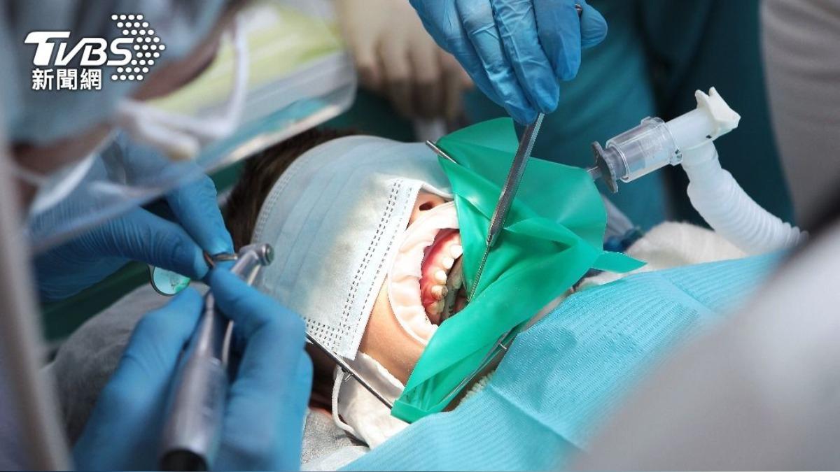 男突然臉腫「口腔冒3公分大白疣」 竟已牙齦癌二期