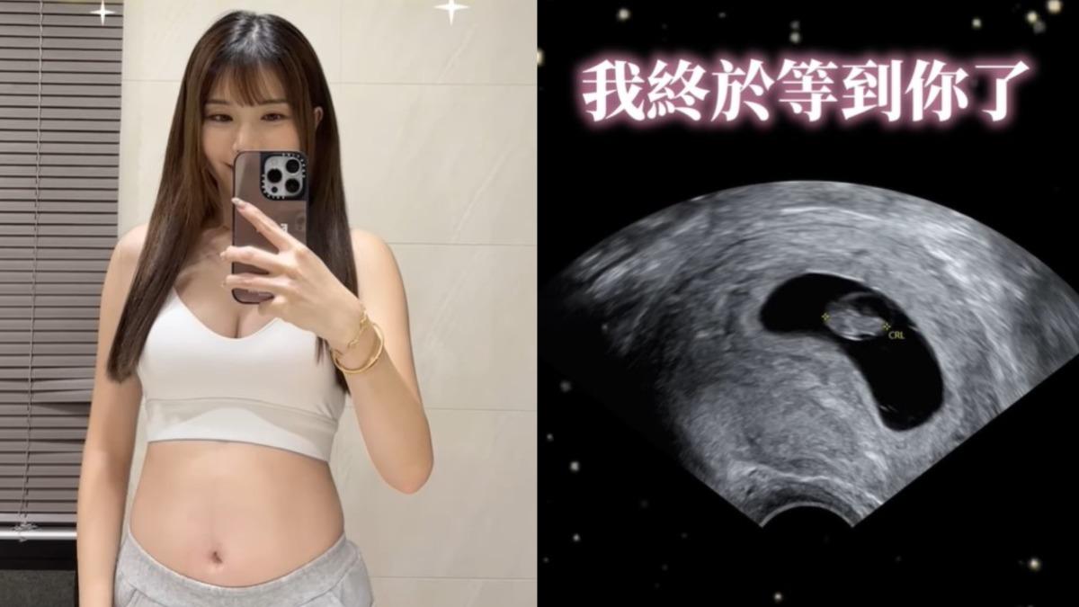 淚認難受孕！電競女神瑀熙求子1年　挺肚曬辣照：終於等到你
