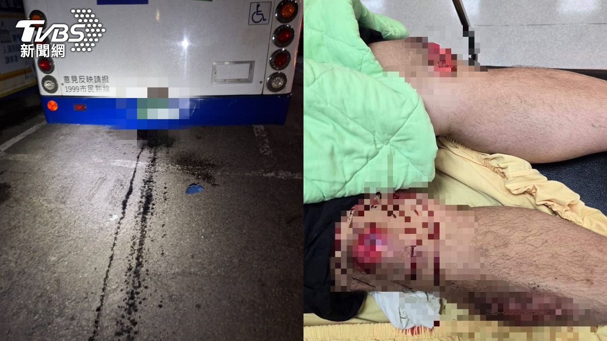 基隆公車漏油害10人慘摔!外送員肋骨斷7根 網批市府無作為