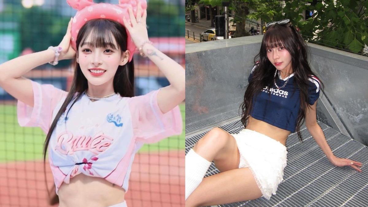 林襄嘴巴腫起來了!飛韓做醫美打玻尿酸竟「1疏忽」:被自己幽默到