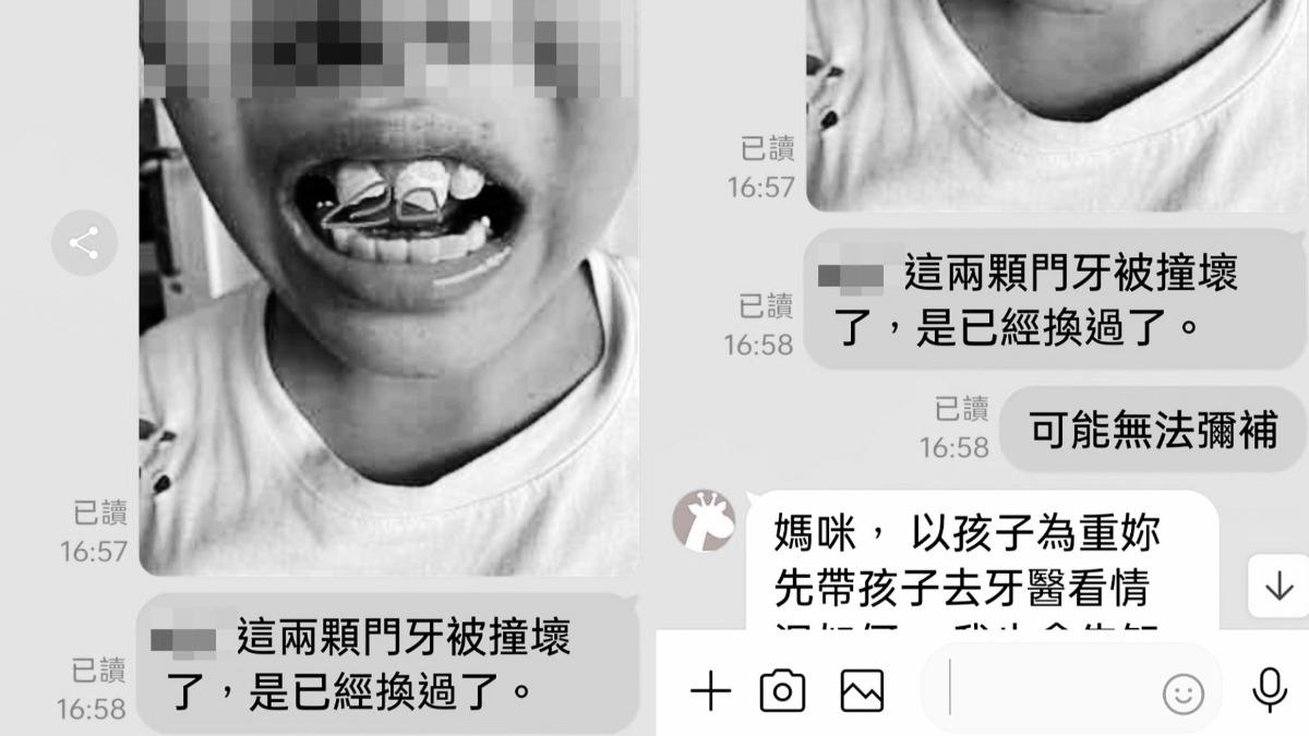 台中國小生「上課被騎頭上」!2門牙全打斷 同學家長嗆:家裡沒錢賠