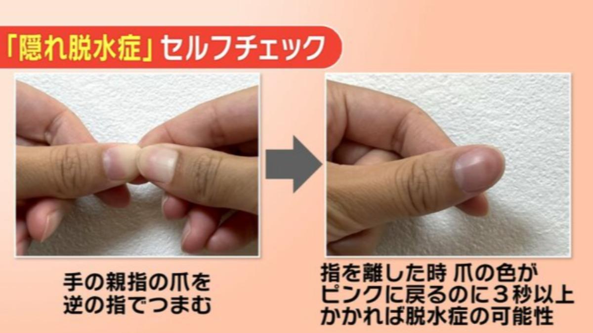按壓大拇指指甲後,若指甲花3秒以上時間才恢復粉紅色,可能就是隱性缺水。(圖/翻攝自福島TUF)