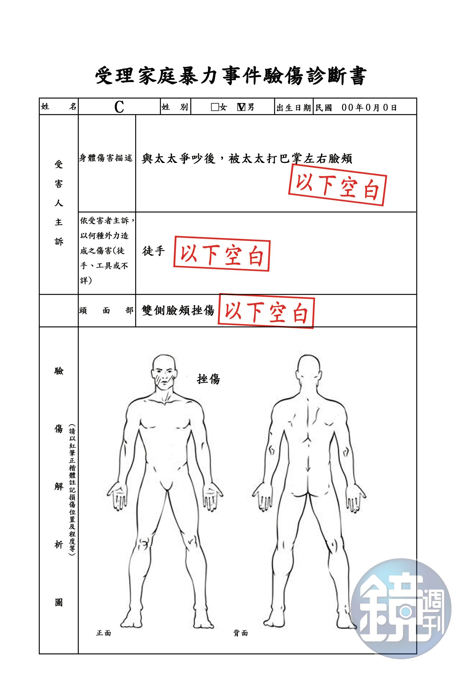 遭妻呼了數次巴掌後，醫院驗傷單清楚寫下雙側臉頰挫傷，成第三勢力要角C聲請保護令的鐵證。（圖／鏡週刊）
