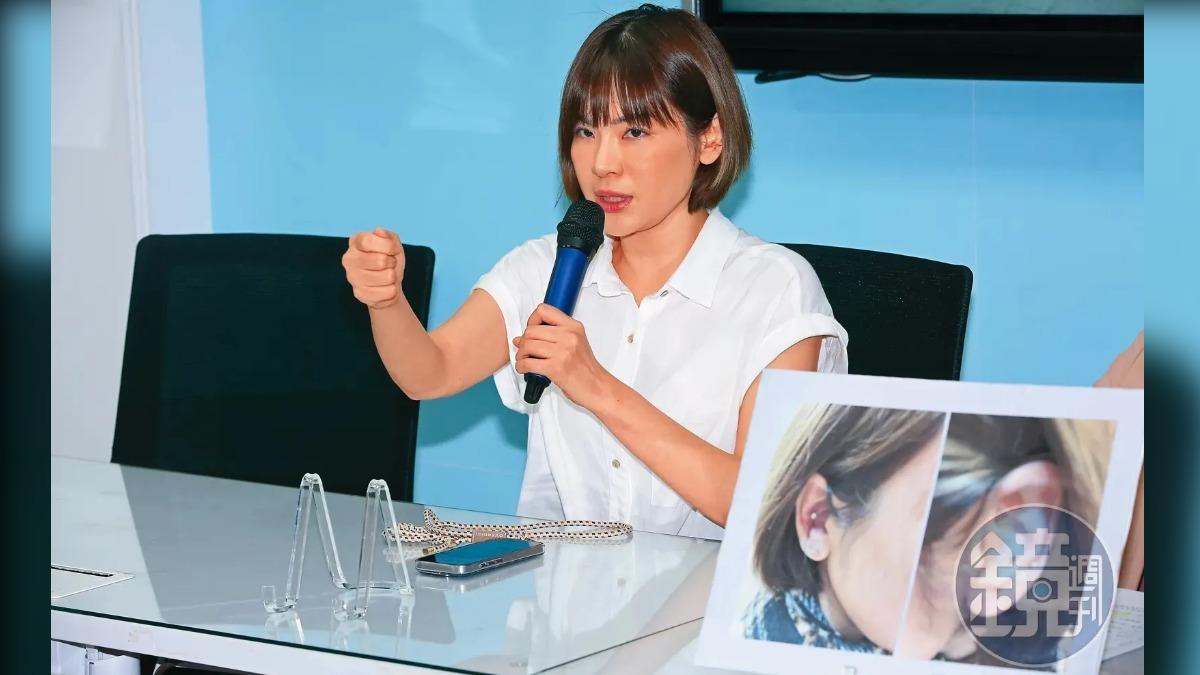陳沂慘了!臉書「無預警被停權」 31萬追蹤全沒了