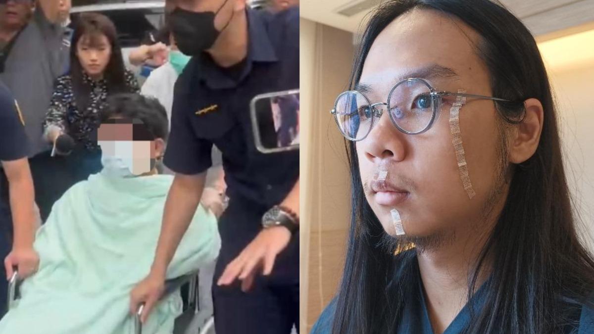 中捷嫌砍左臉留9公分疤痕!今遭殺人未遂起訴 長髮哥回應了