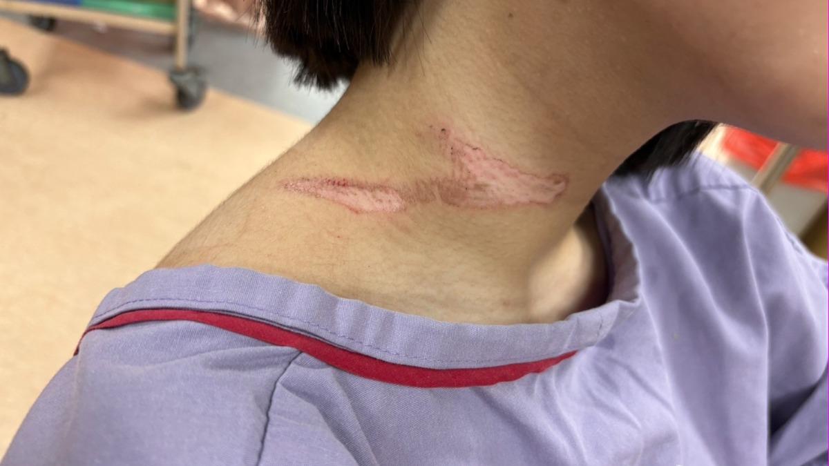 徐姓女騎士及後座朱女遭電線勒傷脖子 。(圖/TVBS)