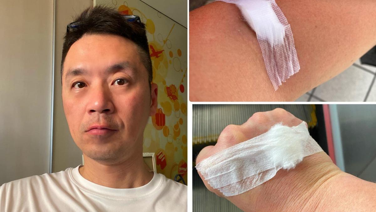 血尿1個月!知名主持人被醫師宣告「恐怕是癌症」崩潰了