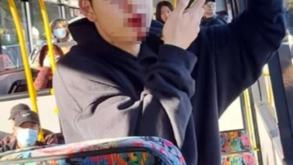 陸留學生「搭公車遇襲」!遭鐵棍爆打 他滿臉血衰斷5顆牙