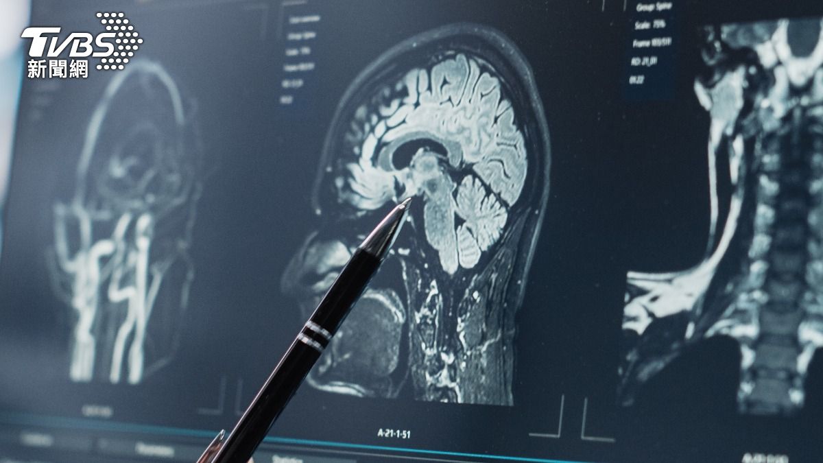 爽嗑豬血「寄生蟲爬滿腦」!誤當補品吃 陸6旬翁暈倒爆警訊